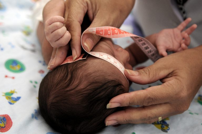 Profissional de saúde medindo o perímetro cefálico de um bebê com fita métrica, em alusão ao diagnóstico da microcefalia.