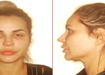 Mulher de cabelos claros e presos em foto de frente e perfil com expressão neutra em fundo claro