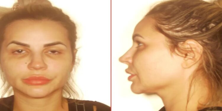 Mulher de cabelos claros e presos em foto de frente e perfil com expressão neutra em fundo claro