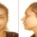 Mulher de cabelos claros e presos em foto de frente e perfil com expressão neutra em fundo claro
