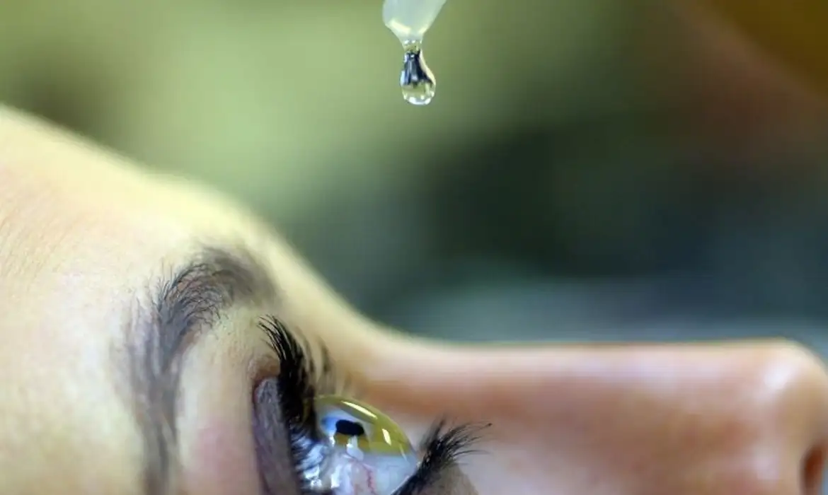 Colírio com corticoide aplicado sem prescrição, hábito que eleva a pressão ocular e o risco de glaucoma e cegueira.
